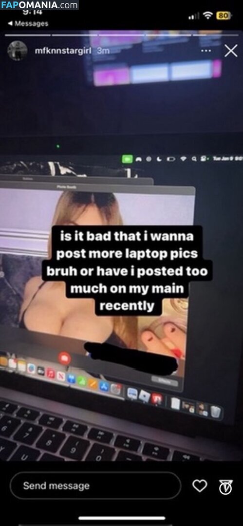 Mfknnstargirl Nago OnlyFans  Przeciekłe zdjęcie #12